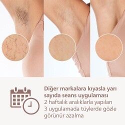 Phılıps Lumea Brı950/02 450.000 Atım Kablosuz Lazer Epılasyon - 5